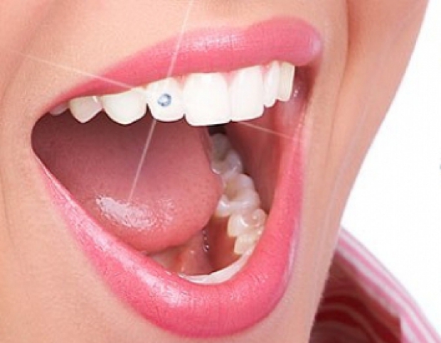 Восстановление зубов взрослым и детям